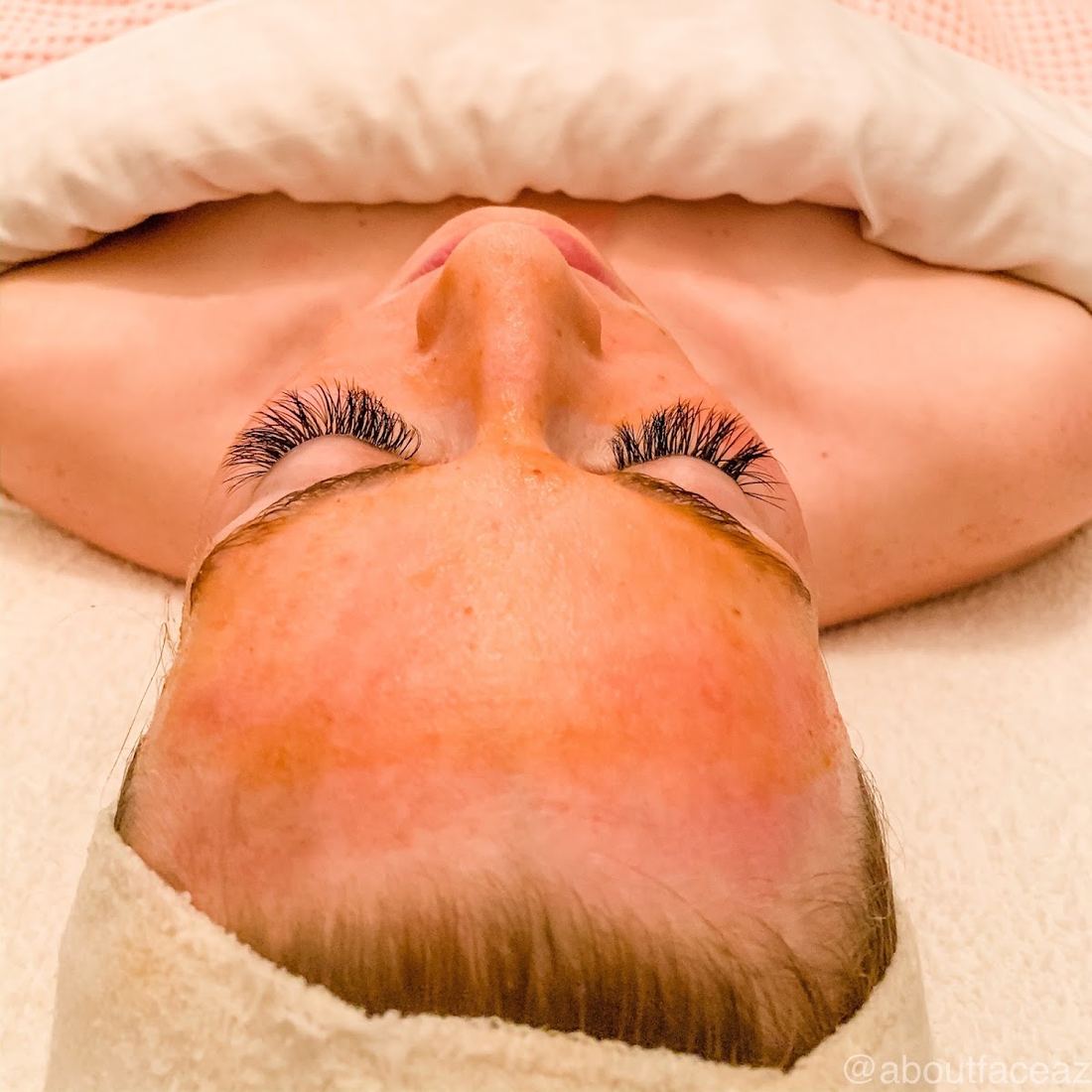 Client with a fresh, even complexion resting after a facial