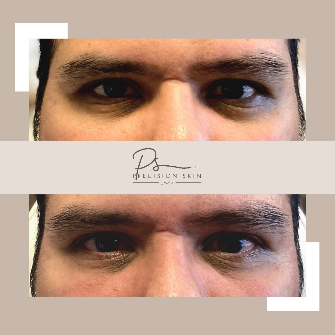 Two-panel photo of the eye area shared by the studio, top and bottom