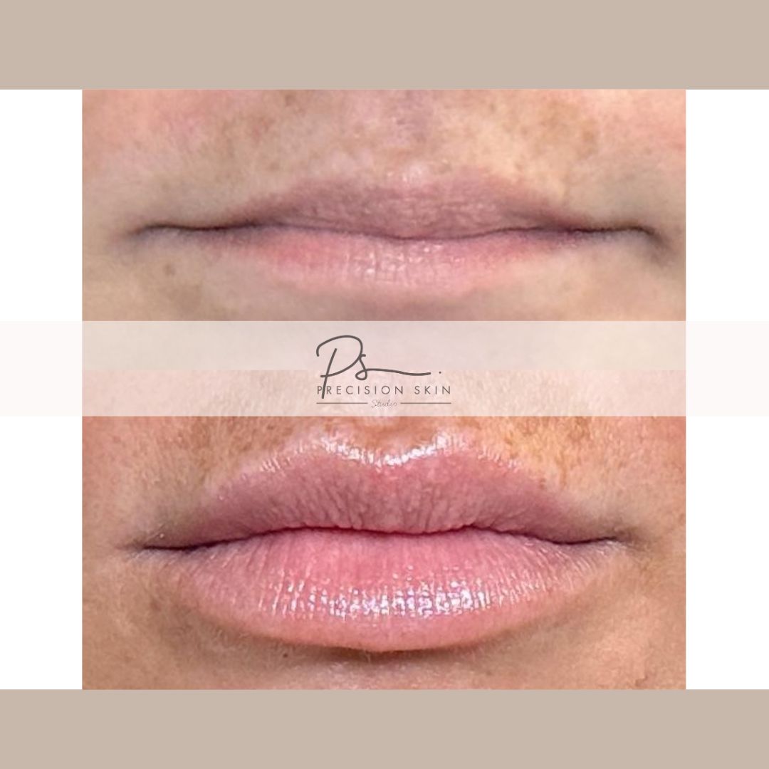 Two-panel photo of the lips shared by the studio